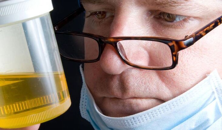 análise de urina para prostatite crônica