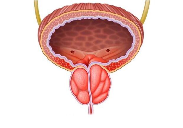 tratamento da prostatite em homens
